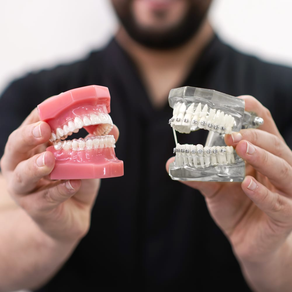 Clear Aligners or Braces at Munk Orthodontics