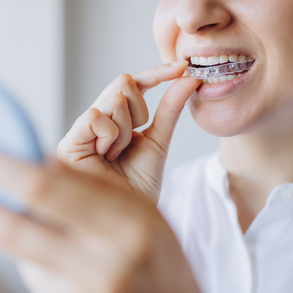 A woman is putting in clear aligners.